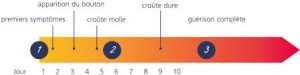 bouton de fievre3