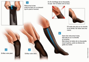 enfiler-bas-de-contention